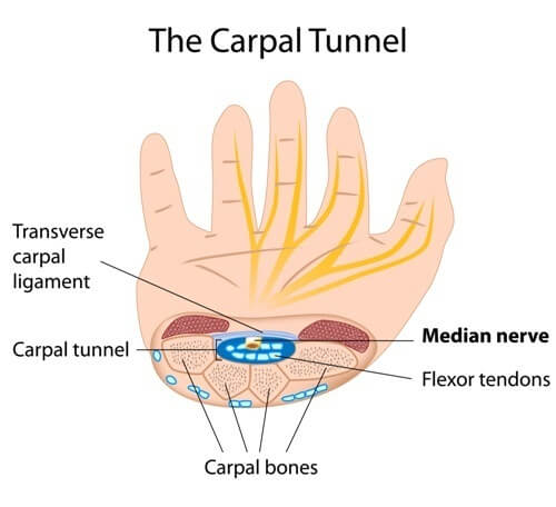karpalny tunel